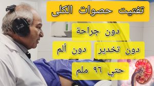 تفتيت الحصى ESWL، علاج الحصى في إيران، مركز تفتيت الحصى مشهد، السياحة العلاجية مشهد،الدكتور فرهادي